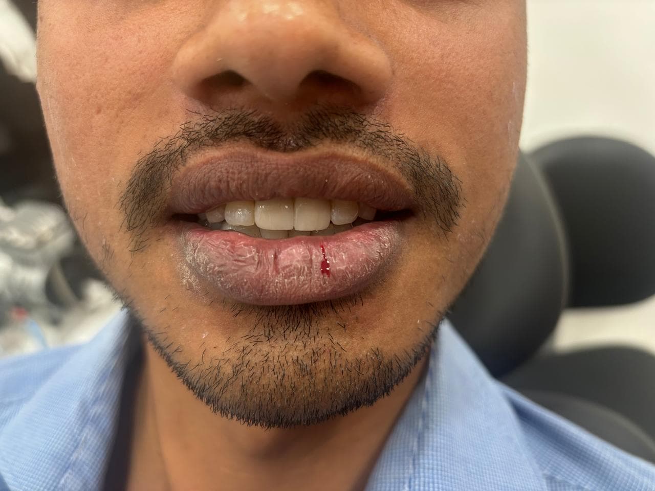 Emergency Trauma Care